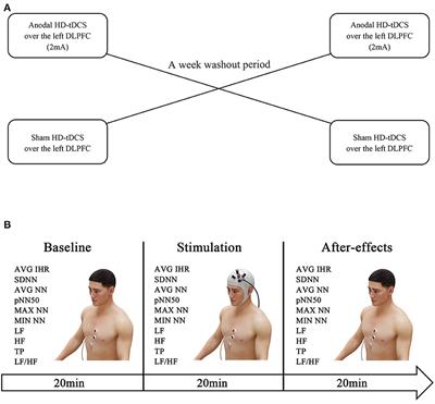 Anodal high-definition transcranial direct current stimulation reduces heart rate and modulates heart-rate variability in healthy young people: A randomized cross-controlled trial